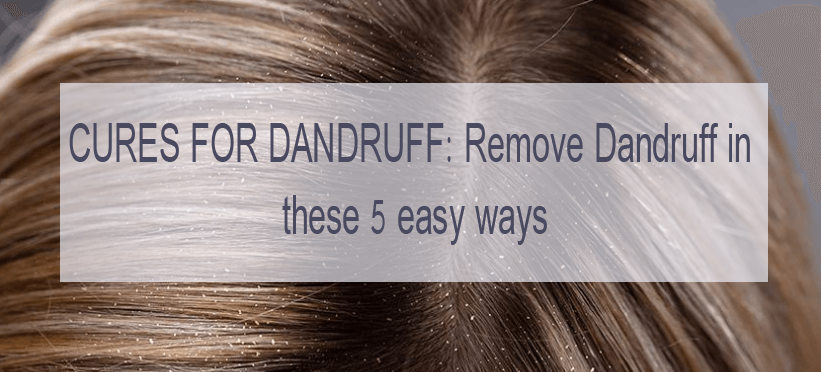 remove dandruff
